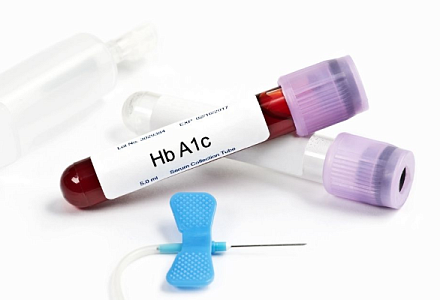 Гликированный гемоглобин отечественного производства